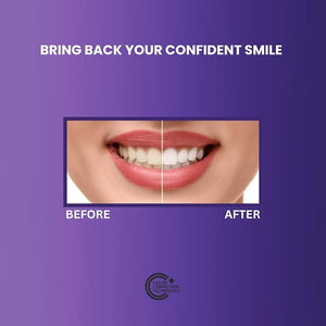 CLAIR Teeth Whitening Strips