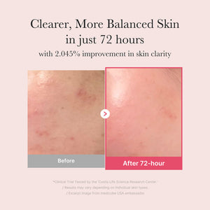 MEDICUBE 15% Niacinamide Serum 30ml