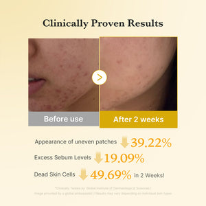 MEDICUBE Kojic Acid Turmeric Toner Pad
