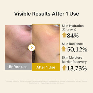 MEDICUBE Kojic Acid Turmeric Vitamin Gold Jelly Mist Serum