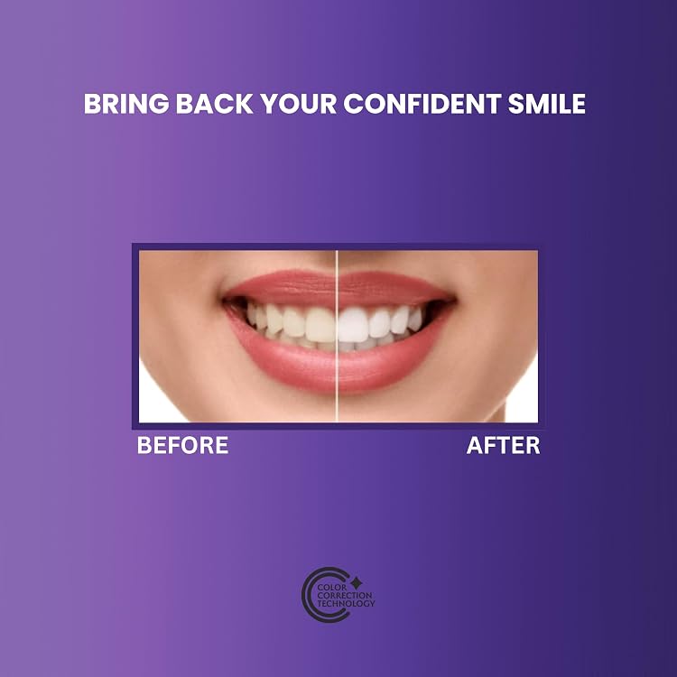 CLAIR Teeth Whitening Strips